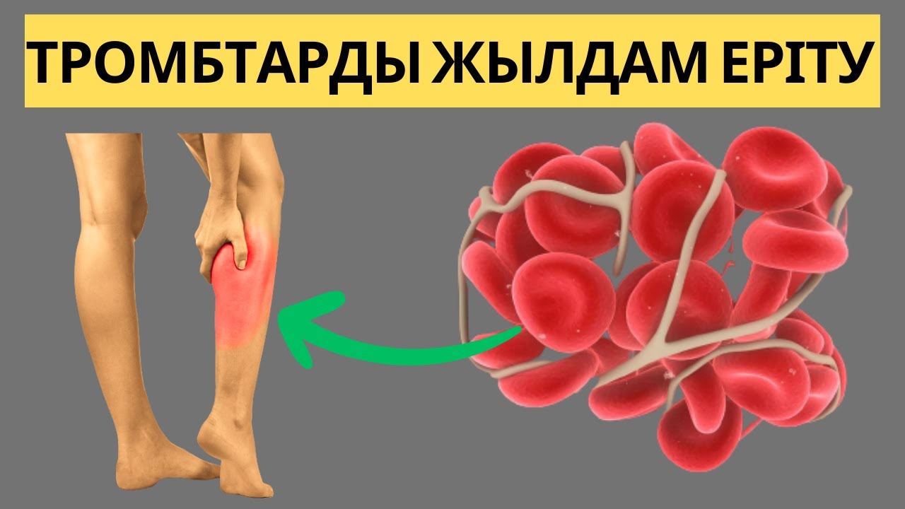 Дикті толығымен жұтады