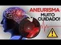 SINTOMAS DE UM ANEURISMA: QUANDO DEVO ME PREOCUPAR? | Dr Dayan Siebra