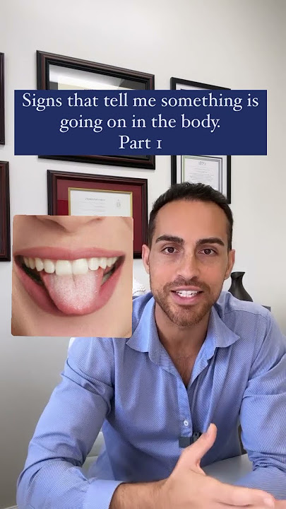 Do You Have A White Coat On Your Tongue? #candida #tongue #guthealth