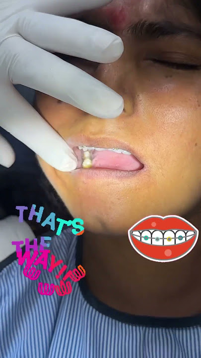 Work as usual at JK Dental 🦷🦷