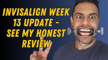 Invisalign My Honest Review (WEEK 13) - Fixing My Smile & My Mental Health (Emo’s Not Dead)
