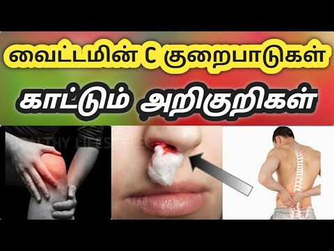 வைட்டமின் C குறைபாடு காட்டும் அறிகுறிகள் | Signs and Symptoms of Vitamin C Deficiency in Tamil