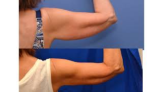 PLASMA ARMS THREE MONTHS screenshot 4