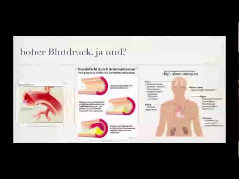 Video: Präoperatives Risiko, Blutdruck Und Akute Nierenverletzung