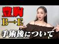 【遂にやりました】絶対にやらないと決めていた豊胸をした理由をお伝えします。