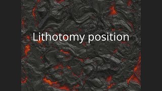 Lithotomy position