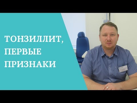 Тонзиллит, первые признаки