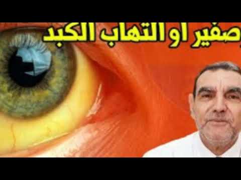 للقضاء على بوصفير أو إلتهاب الكبد في يوم واحد د محمد الفايد