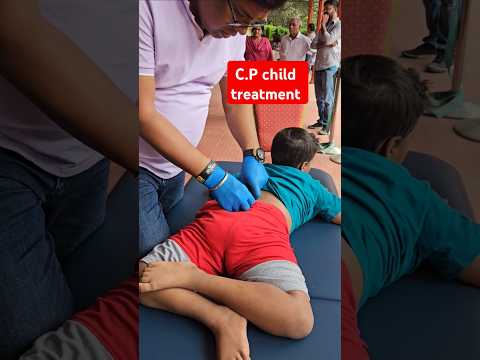 C.P child treatment