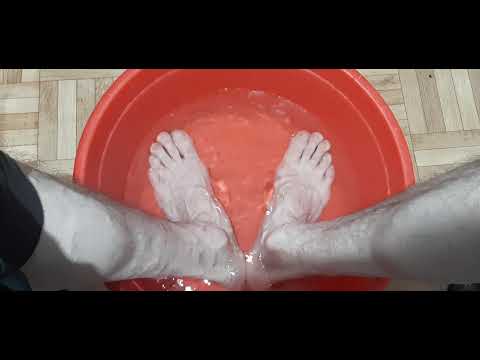 Как избавиться от потливости ног