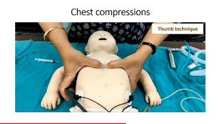 Neonatal Resuscitation (Part-4) | 2020 AAP Guidelines | Chest Compression (Step-C) | Pediatrics