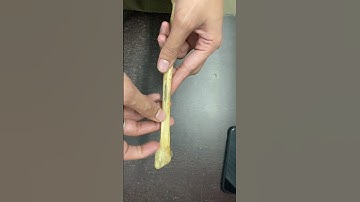 RADIUS under 60 seconds