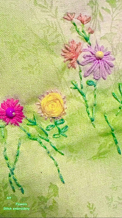 Stitches