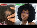 I WAS GOING BALD via SCALP FUNGUS (4C/B/A NATURAL HAIR) + GROW back MY JOURNEY #ScalpCare | EfikZara