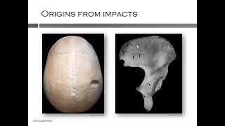 Forensic Fractography of Bone  A New Model for Skeletal Trauma Analysis