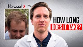 Brutally Honest Timeline For Hair Regrowth With Dht Blocker