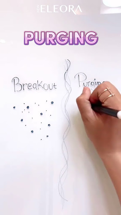 APA YA BEDANYA PURGING DENGAN BREAKOUT?