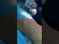 Пластика живота и груди: ИНТЕРВЬЮ ХИРУРГА