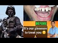 Best Dental transformation of NSG Commando its Our pleasure to treat you | Smile😀 🙏