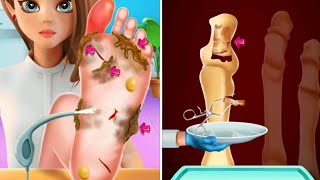 Foot finger surgery in foot doctor games !! #footdoctor #finger screenshot 1