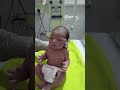 Moro reflex in nicu 😱😱#shorts  #ytshorts#cutebaby #newborn #nicucare #hospitalcare