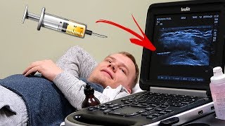 ЧТО С КОЛЕНОМ? ОТКАЧАЛИ ШПРИЦОМ ЖИДКОСТЬ! ЧТО С КОЛЕНОМ? ОТКАЧАЛИ ШПРИЦОМ ЖИДКОСТЬ!