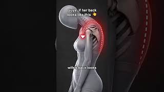 Guys, if her back looks like this 👆 #posturebra #wirefreebra #shorts