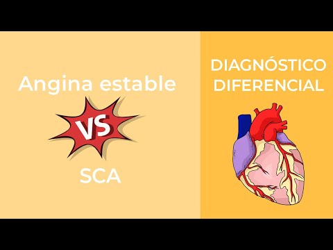 Vídeo: Angina - Diagnóstico Diferencial De Angina Y Difteria