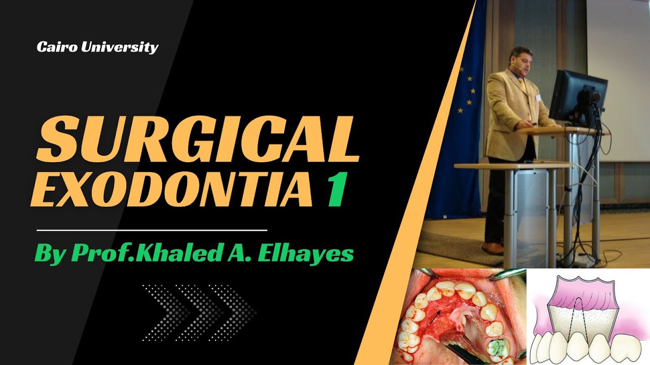SURGICAL EXODONTIA 1 (Steps of Surgical Extraction & Requirements of Ideal Flap)