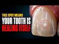 Reverse Tooth Decay at Home