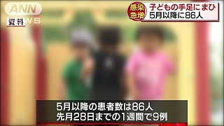 咳やくしゃみで・・・子どもの手足にまひが出る感染症(18/11/07)