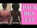 HOW I LOST MY BACK FAT || Resistance Bands