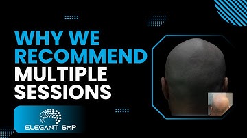 Why We Recommend Multiple Sessions For SMP