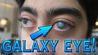 WHAT THE HELL HAPPENED TO HIS EYE!? (GALAXY EYE)