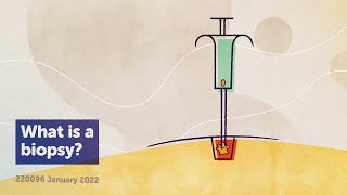 What is a biopsy? [PART 3 - VIDEO 1]