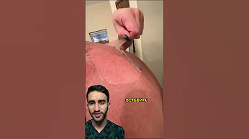 кожа слазит как у змеи? это солнченый ожог