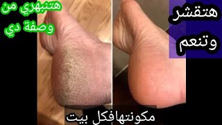 وصفة جبارة لخشونة الكعب الرجل والتشققات الرجل هتتبهري 