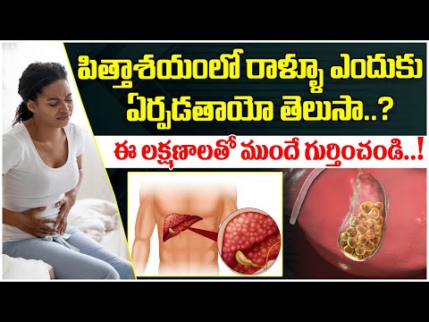 What is Gallbladder in Telugu | Gallbladder Stone Causes and Treatment | Gallbladder Stone Symptoms