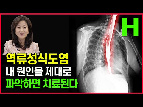 역류성식도염 증상 원인 해결책 제대로 알면 스스로 고칠 수 있습니다! 이것만 꼭 알아두세요!