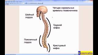 Правда про Нарушение Осанки