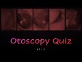 Otoscopy quiz 1  5