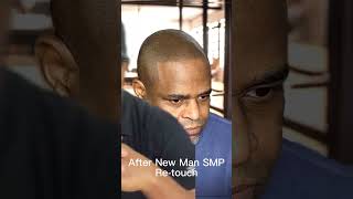 How Long Does SMP Last? 🤔 #scalpmicropigmentation #hairlosssolution #atlantasmp #menshairloss