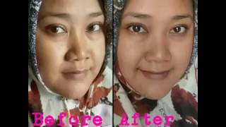 Solusi Jerawat Beruntusan | Pure Skin Oriflame | Sharing-sharing with Mays