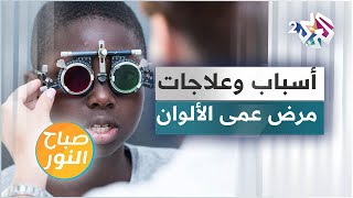 مرض عمى الألوان .. الأسباب والعلاجات