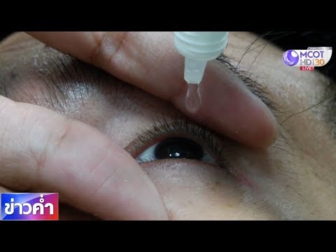 ชัวร์ก่อนแชร์ : ใช้น้ำตาเทียมบ่อยๆ ดวงตาไม่ผลิตน้ำตา จริงหรือ?