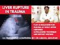 Liver trauma ultrasound | liver injury | blunt abdominal trauma | liver ultrasound normal vs abnomal