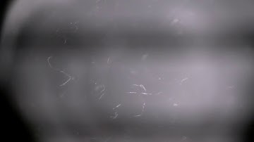 Nematodes under infrared light captured on Raspberry Pi DIY Microscope