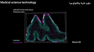 Technologies enable 3D imaging of whole human brain hemispheres at subcellular resolution