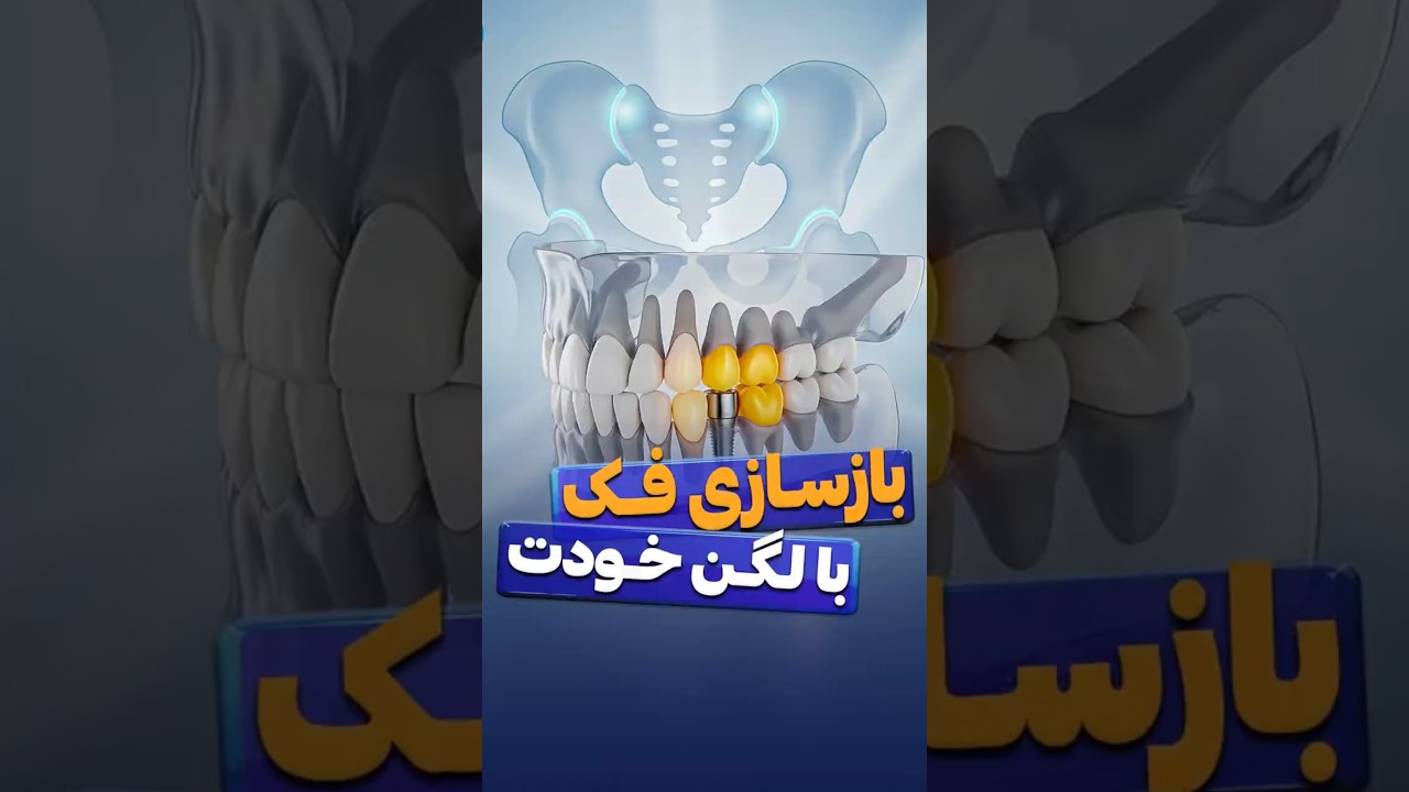 کاور ویدیوی یوتیوب