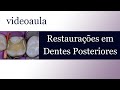 10º Aula Dentística - Restaurações em Dentes Posteriores